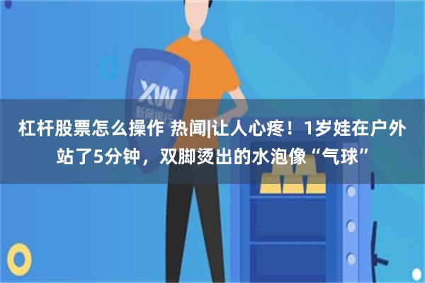 杠杆股票怎么操作 热闻|让人心疼！1岁娃在户外站了5分钟，双脚烫出的水泡像“气球”